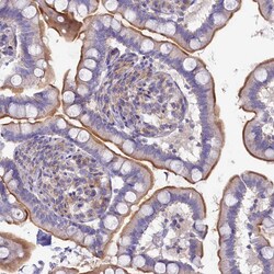 Invitrogen VPS26B Polyclonal Antibody 100 &mu;L; Unconjugated:Antibodies,