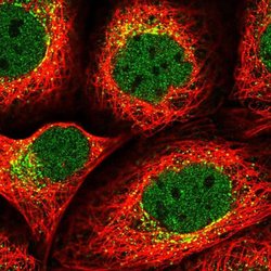 Invitrogen SEC24B Polyclonal Antibody 100 &mu;L; Unconjugated:Antibodies,