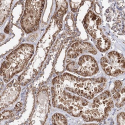 Invitrogen SEC24B Polyclonal Antibody 100 &mu;L; Unconjugated:Antibodies,