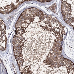 Invitrogen SEC24B Polyclonal Antibody 100 &mu;L; Unconjugated:Antibodies,