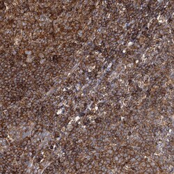 Invitrogen SEC24B Polyclonal Antibody 100 &mu;L; Unconjugated:Antibodies,