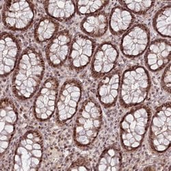Invitrogen FAM204A Polyclonal Antibody 100 &mu;L | Buy Online | Invitrogen&trade; | Fisher Scientific