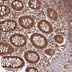 Invitrogen NPRL2 Polyclonal Antibody 100 &mu;L; Unconjugated:Antikörper