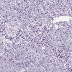 Invitrogen CREG2 Polyclonal Antibody 100 &mu;L; Unconjugated:Antibodies,