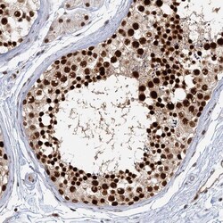 Invitrogen GPATCH11 Polyclonal Antibody 100 &mu;L; Unconjugated:Antibodies,