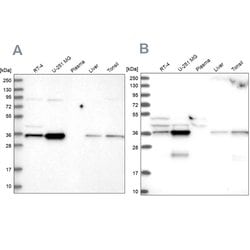 Invitrogen GPATCH11 Polyclonal Antibody 100 &mu;L; Unconjugated:Antibodies,