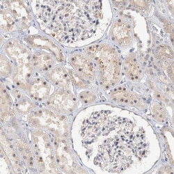 Invitrogen GPATCH11 Polyclonal Antibody 100 &mu;L; Unconjugated:Antibodies,