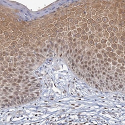 Invitrogen GPATCH11 Polyclonal Antibody 100 &mu;L; Unconjugated:Antibodies,