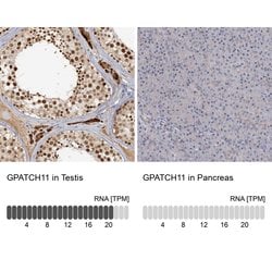 Invitrogen GPATCH11 Polyclonal Antibody 100 &mu;L; Unconjugated:Antibodies,