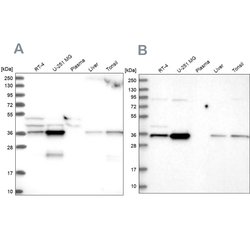Invitrogen GPATCH11 Polyclonal Antibody 100 &mu;L; Unconjugated:Antibodies,