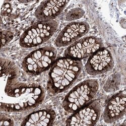 Invitrogen PARM1 Polyclonal Antibody 100 &mu;L; Unconjugated:Antibodies,