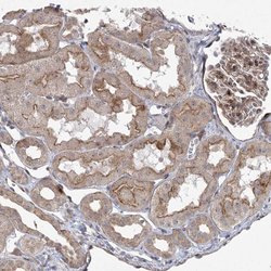 Invitrogen PARM1 Polyclonal Antibody 100 &mu;L; Unconjugated:Antibodies,