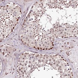 Invitrogen TTC33 Polyclonal Antibody 100 &mu;L; Unconjugated:Antibodies,