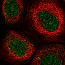 Invitrogen TTC33 Polyclonal Antibody 100 &mu;L; Unconjugated:Antibodies,
