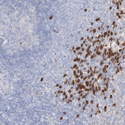 Invitrogen NIPA4 Polyclonal Antibody 100 &mu;L; Unconjugated:Antibodies,