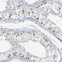 Invitrogen Connexin 40.1 Polyclonal Antibody 100 &mu;L; Unconjugated:Antibodies,