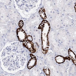 Invitrogen SLC17A2 Polyclonal Antibody 100 &mu;L; Unconjugated:Antibodies,