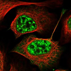 Invitrogen PRPF40A Polyclonal Antibody 100 &mu;L | Buy Online | Invitrogen&trade; | Fisher Scientific