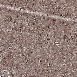 Invitrogen PRPF40A Polyclonal Antibody 100 &mu;L | Buy Online | Invitrogen&trade; | Fisher Scientific