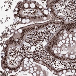 Invitrogen PRPF40A Polyclonal Antibody 100 &mu;L | Buy Online | Invitrogen&trade; | Fisher Scientific
