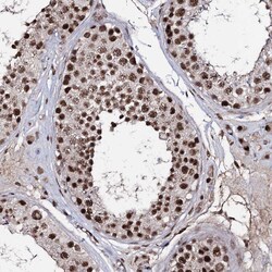 Invitrogen PRPF40A Polyclonal Antibody 100 &mu;L | Buy Online | Invitrogen&trade; | Fisher Scientific