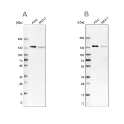Invitrogen PRPF40A Polyclonal Antibody 100 &mu;L | Buy Online | Invitrogen&trade; | Fisher Scientific