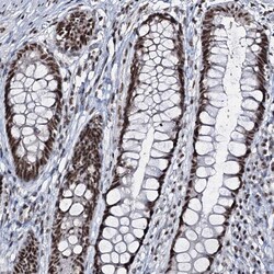 Invitrogen PRPF40A Polyclonal Antibody 100 &mu;L; Unconjugated:Antibodies,