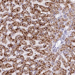 Invitrogen SPINK9 Polyclonal Antibody 100 &mu;L; Unconjugated:Antibodies,