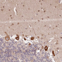 Invitrogen TMIE Polyclonal Antibody 100 &mu;L; Unconjugated:Antibodies,