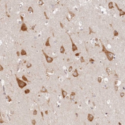 Invitrogen TMIE Polyclonal Antibody 100 &mu;L; Unconjugated:Antibodies,
