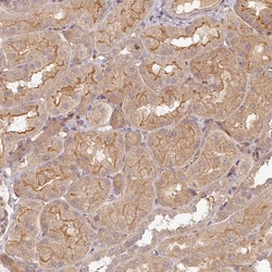 Invitrogen TMIE Polyclonal Antibody 100 &mu;L; Unconjugated:Antibodies,