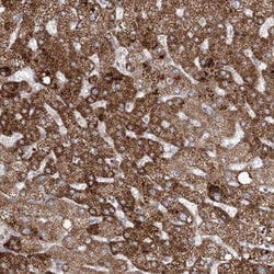 Invitrogen ECHDC3 Polyclonal Antibody 100 &mu;L; Unconjugated:Antibodies,