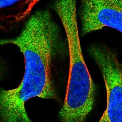 Invitrogen RPAP3 Polyclonal Antibody 100 &mu;L; Unconjugated:Antibodies,