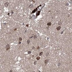 Invitrogen RPAP3 Polyclonal Antibody 100 &mu;L; Unconjugated:Antibodies,