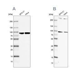 Invitrogen RPAP3 Polyclonal Antibody 100 &mu;L; Unconjugated:Antibodies,