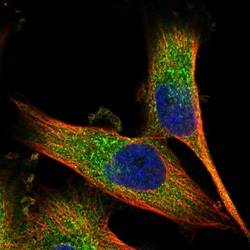 Invitrogen CALCOCO1 Polyclonal Antibody 100 &mu;L; Unconjugated:Antibodies,