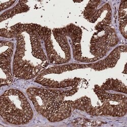 Invitrogen DHX29 Polyclonal Antibody 100 &mu;L; Unconjugated:Antibodies,