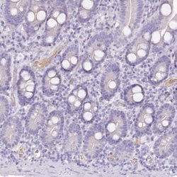 Invitrogen HPD Polyclonal Antibody 100 &mu;L; Unconjugated:Antibodies,