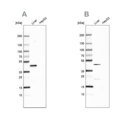 Invitrogen HPD Polyclonal Antibody 100 &mu;L; Unconjugated:Antibodies,
