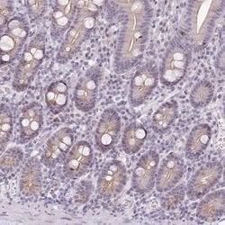 Invitrogen HPD Polyclonal Antibody 100 &mu;L; Unconjugated:Antibodies,