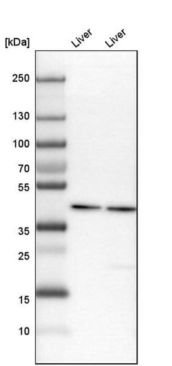 Invitrogen HPD Polyclonal Antibody 100 &mu;L; Unconjugated:Antibodies,