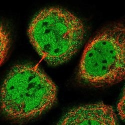 Invitrogen ST7 Polyclonal Antibody 100 &mu;L; Unconjugated:Antibodies,