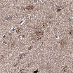 Invitrogen BUD13 Polyclonal Antibody 100 &mu;L; Unconjugated:Antibodies,