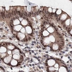 Invitrogen BUD13 Polyclonal Antibody 100 &mu;L; Unconjugated:Antibodies,