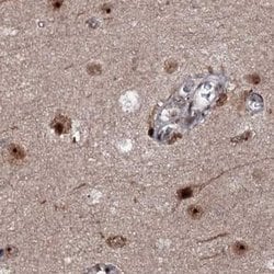 Invitrogen BUD13 Polyclonal Antibody 100 &mu;L; Unconjugated:Antibodies,