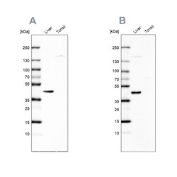 Invitrogen C5orf33 Polyclonal Antibody 100 &mu;L | Buy Online | Invitrogen&trade; | Fisher Scientific