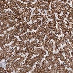 Invitrogen C5orf33 Polyclonal Antibody 100 &mu;L | Buy Online | Invitrogen&trade; | Fisher Scientific