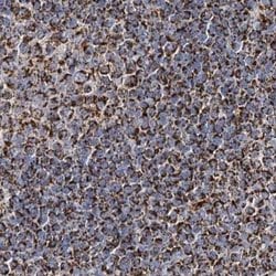 Invitrogen C5orf33 Polyclonal Antibody 100 &mu;L | Buy Online | Invitrogen&trade; | Fisher Scientific