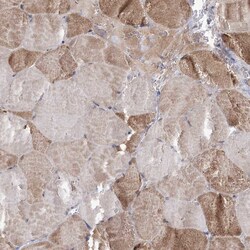 Invitrogen C5orf33 Polyclonal Antibody 100 &mu;L; Unconjugated:Antibodies,
