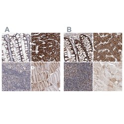 Invitrogen C5orf33 Polyclonal Antibody 100 &mu;L; Unconjugated:Antibodies,